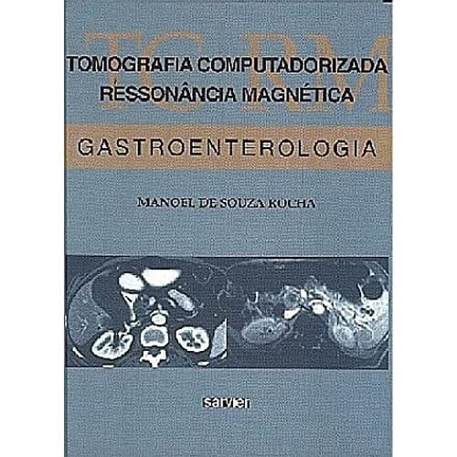 Tomografia computadorizada, ressonância magnética: gastroenterologia