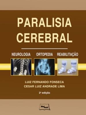 Paralisia cerebral: neurologia, ortopedia, reabilitação